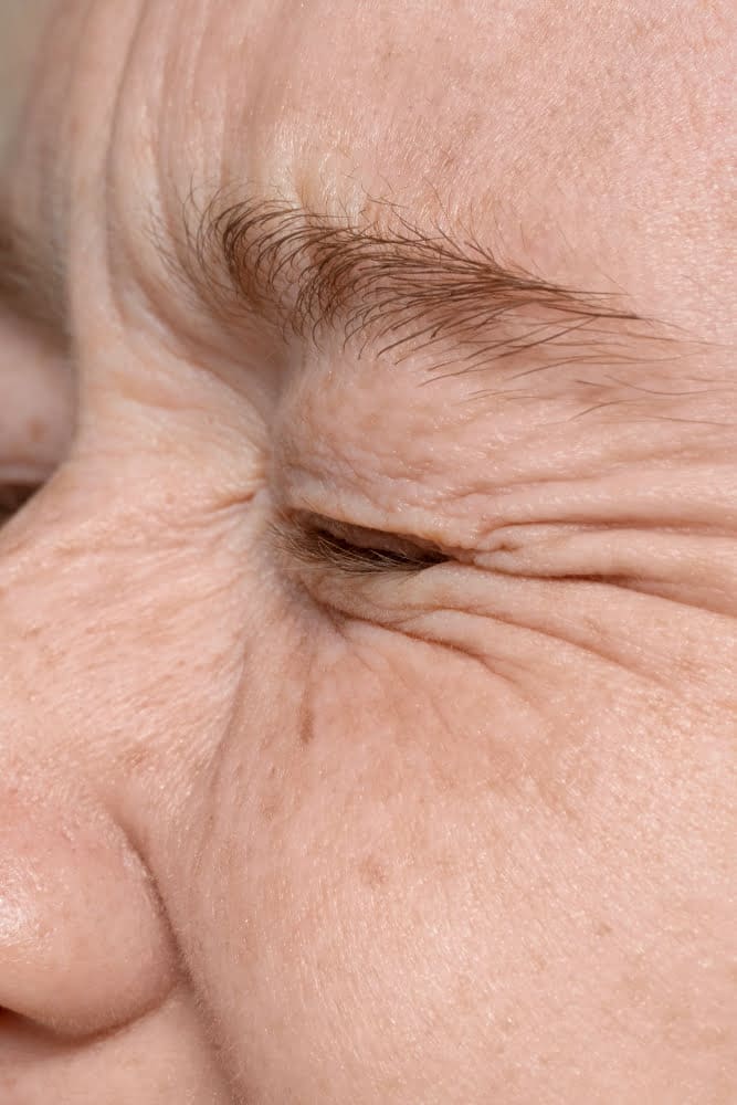 Facial Ageing | Cienna Aesthetics Medical Clinic