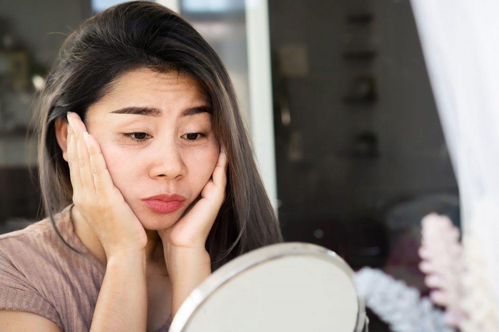 woman having a problem with eye bags, dark circles, wrinkles and crow's feet on her facial skin