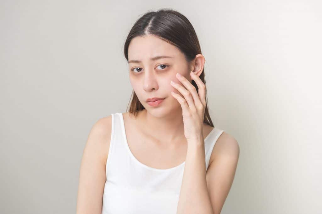 Are Dark Eye Circles Reversible or Permanent