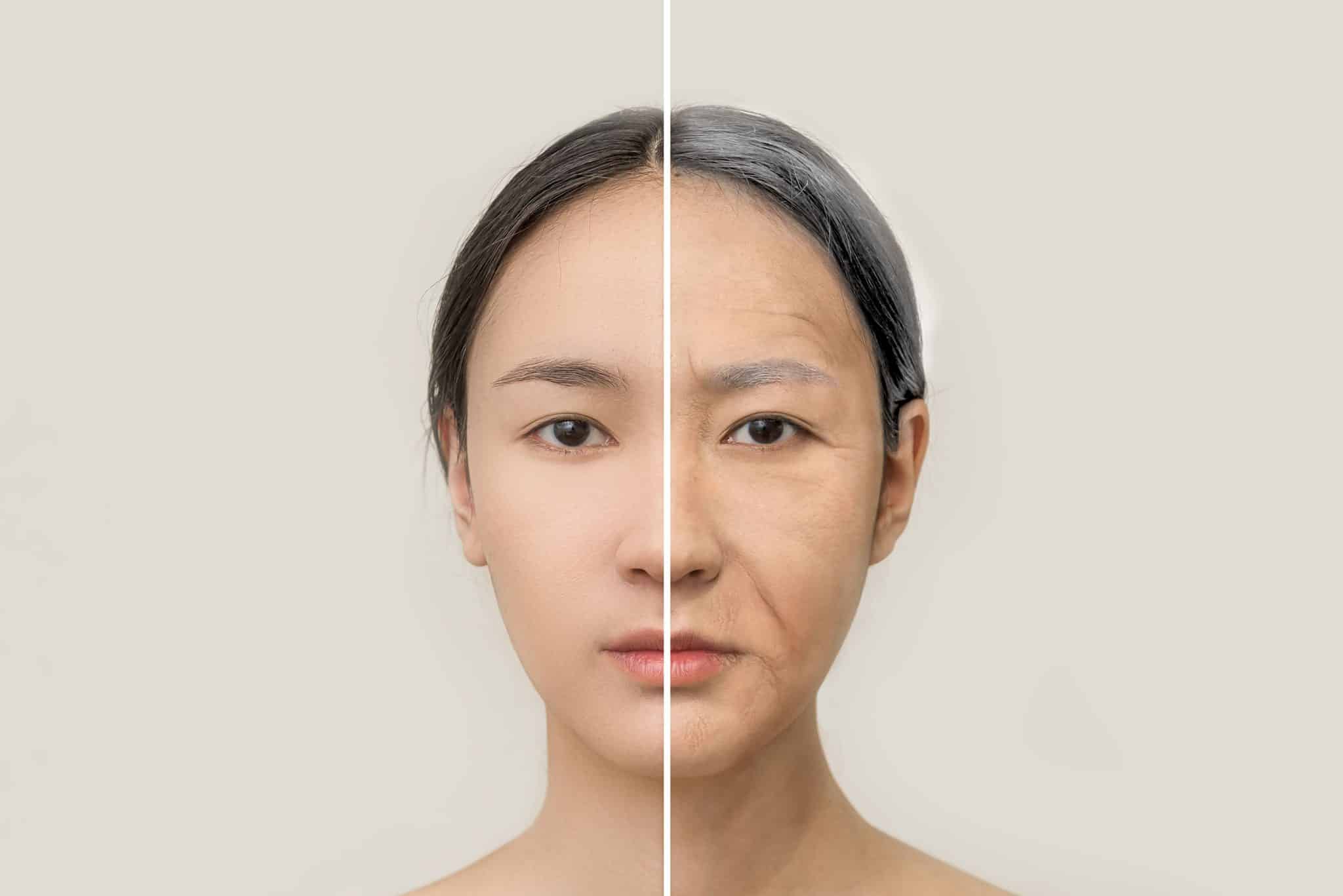 Ageing Dark Eye Circles